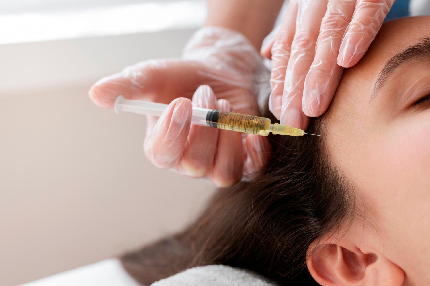 Filler Capilar – Hair Filler
