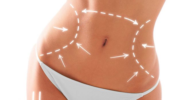 Liposuccion o Vibro Liposuccion