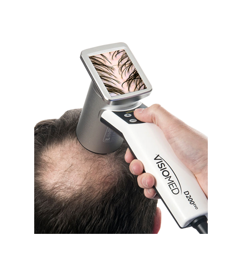 HairMetrix